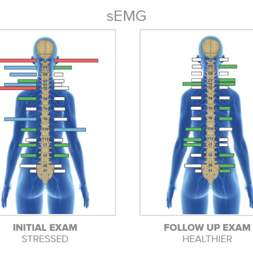 EMG+Before+and+After+1