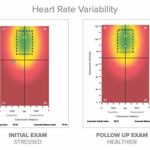 HRV+Before+and+After+1