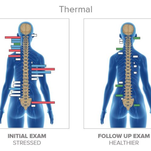 Thermal+Before+and+After+1